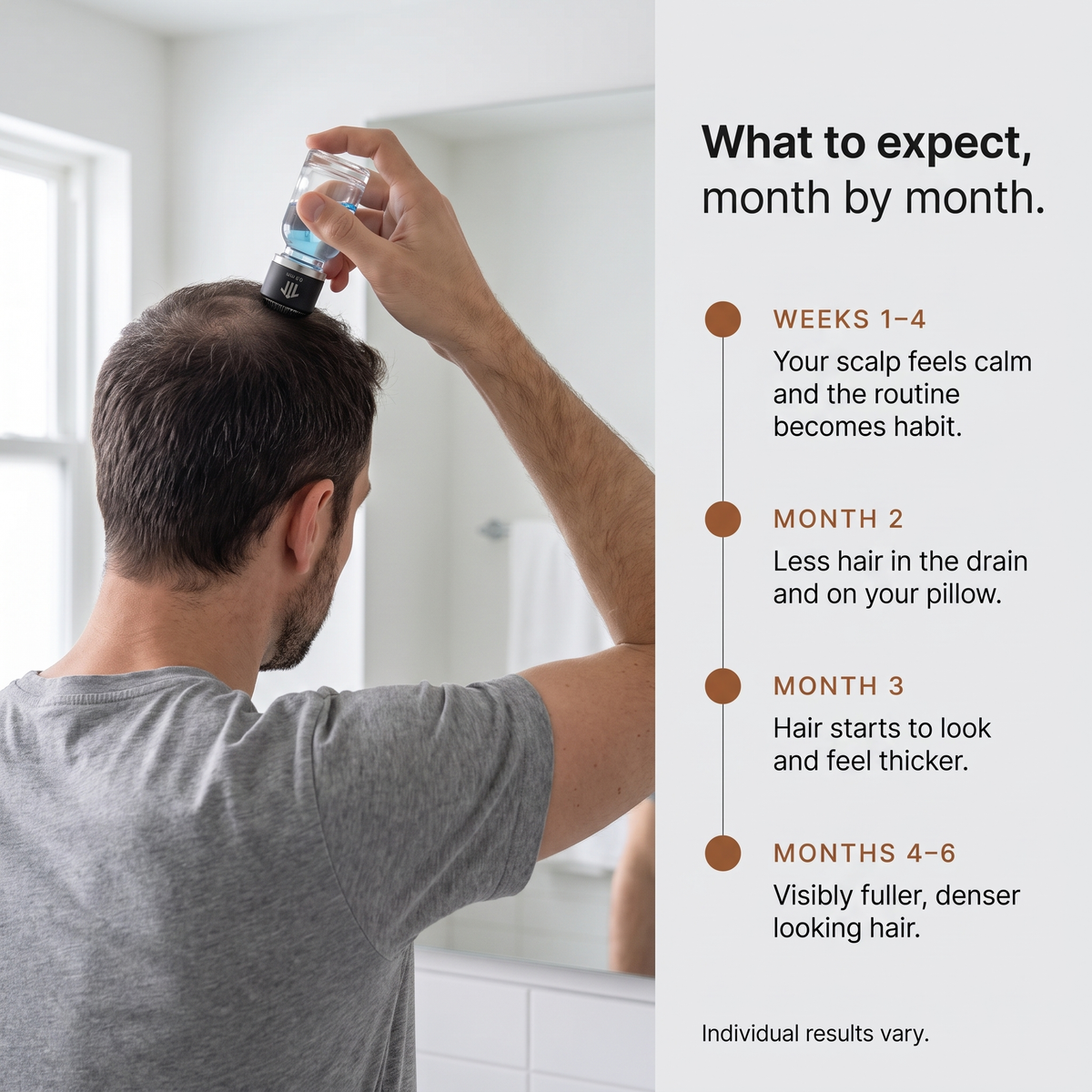 Tenure Hair Regrowth System